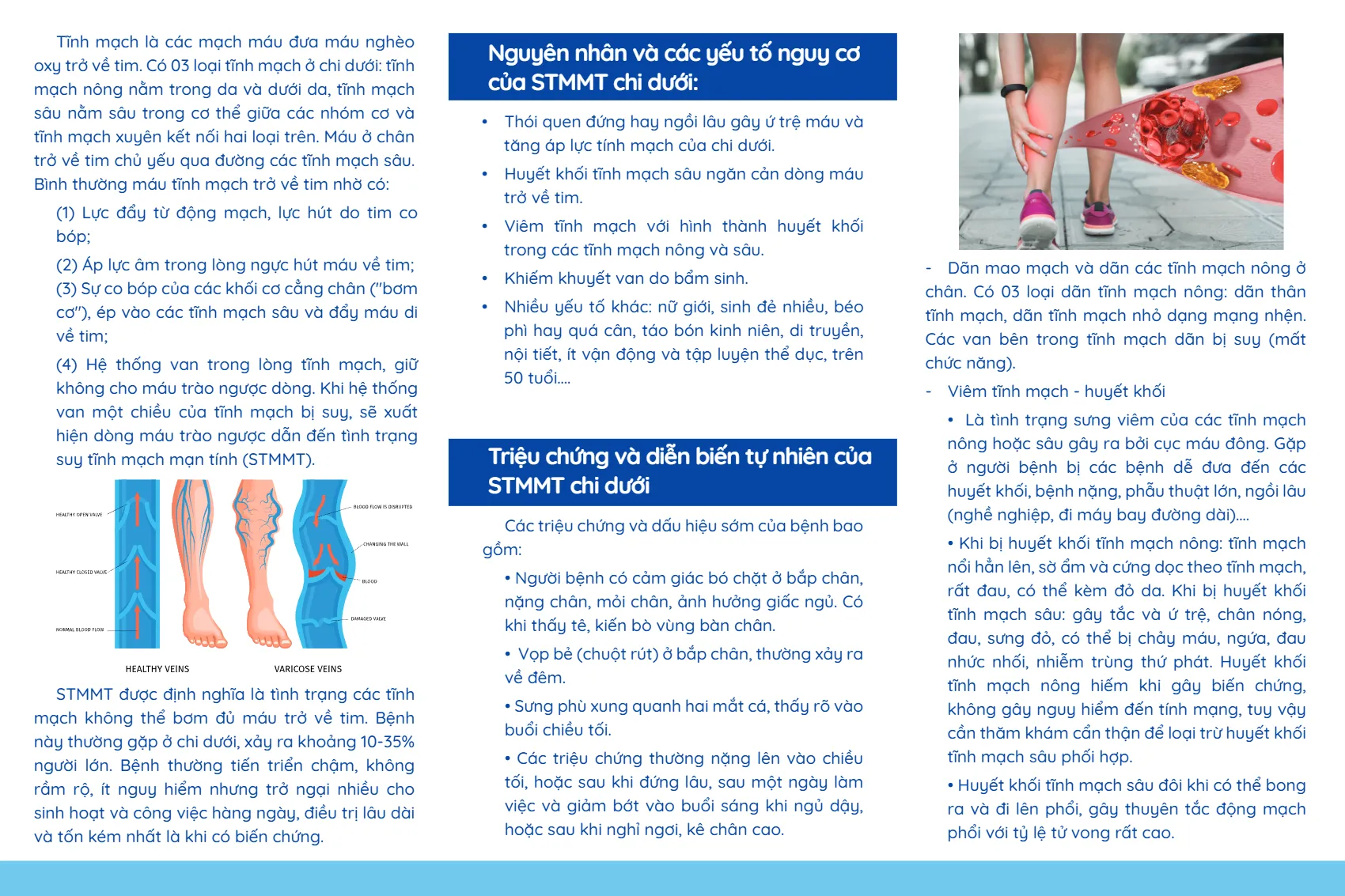 to roi suy giam tinh mach chi duoi_2.webp